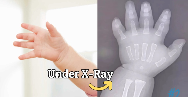 Only 1 in 25 People Pass This Human Body Quiz Without Googling – You In?